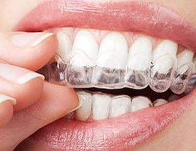 implantes dentales caparroso navarra